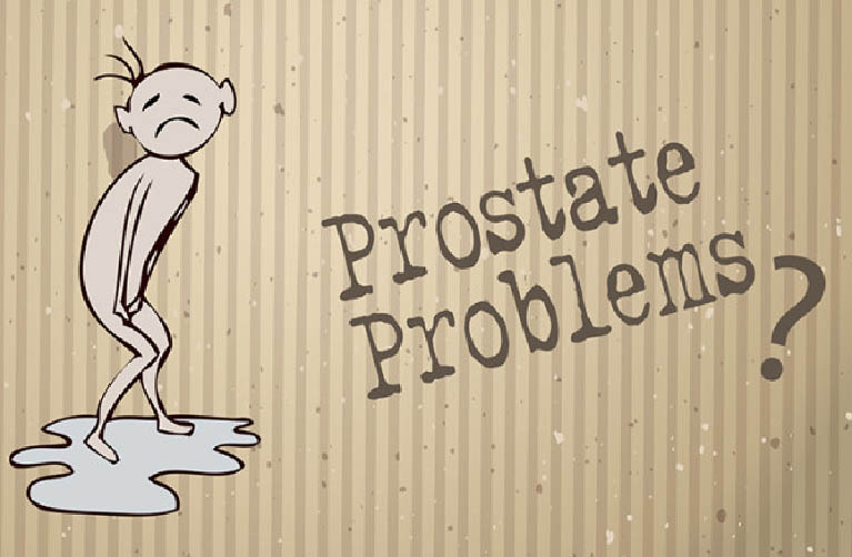 Cause of Enlarged Prostate | prosman